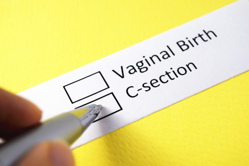 Two options of vaginal birth and c section printed on a piece of paper as a woman goes to tick c section